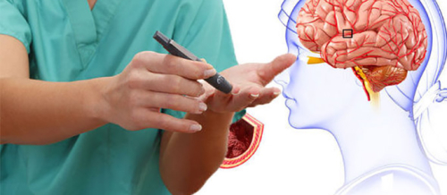 Nevroloji, Epilepsiya, Nevrologiya şöbəsi, Nevrologiya, Nevroloji Xidmətlər Nevroloji, Epilepsiya, Nevrologiya şöbəsi, Nevrologiya, Nevroloji Xidmətlər