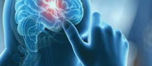 Nevrologiya şöbəsi, nevroloji xəstəliklər, nevroloji müayinə, nevroloji müalicə, neyrocərrahiyyə