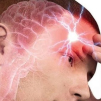 Nevroloji xəstəliklər, Nevrologiya, Mərkəzi Sinir Sistemi, Miqren, Epilepsiya, EEQ