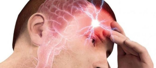 Nevroloji xəstəliklər, Nevrologiya, Mərkəzi Sinir Sistemi, Miqren, Epilepsiya, EEQ Nevroloji xəstəliklər, Nevrologiya, Mərkəzi Sinir Sistemi, Miqren, Epilepsiya, EEQ