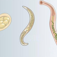 Parazit qurdları, Tibbi Parazitologiya, Qurd xəstəlikləri, helminthologiya, Parazitlərin növü