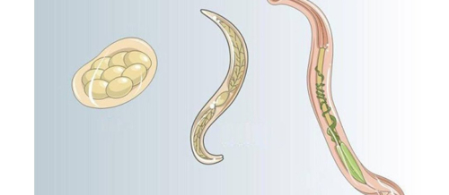 Parazit qurdları, Tibbi Parazitologiya, Qurd xəstəlikləri, helminthologiya, Parazitlərin növü