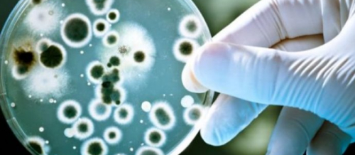 Helmintozlar, Helmintoz növləri, Qurd xəstəliklərinin əlamətləri, Qurdların diaqnozu, Dəri və zöhrəvi xəstəliklər