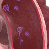 Qurd xəstəlikləri, Azərbaycan qurd xəstəlikləri, Qurd xəstəliklərinin müalicəsi, Qurd xəstəliklərinin əlamətləri