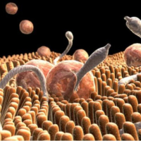 Parazit növləri, Qurd xəstəliklərinə yoluxma, Qurd xəstəliklərinin fərqli əlamətləri, Qurd xəstəliklərinin fəsadları