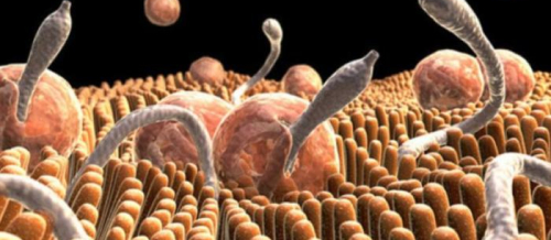 Parazit növləri, Qurd xəstəliklərinə yoluxma, Qurd xəstəliklərinin fərqli əlamətləri, Qurd xəstəliklərinin fəsadları