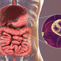 Parazit növləri, Qurd xəstəliklərinə yoluxma, Qurd xəstəliklərinin fərqli əlamətləri, Qurd xəstəliklərinin fəsadları