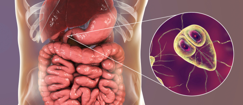 Parazit növləri, Qurd xəstəliklərinə yoluxma, Qurd xəstəliklərinin fərqli əlamətləri, Qurd xəstəliklərinin fəsadları