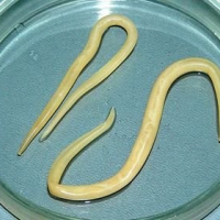 Parazit növləri, Qurd xəstəliklərinə yoluxma, Qurd xəstəliklərinin fərqli əlamətləri, Qurd xəstəliklərinin fəsadları