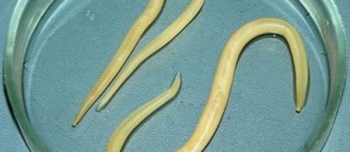 Parazit növləri, Qurd xəstəliklərinə yoluxma, Qurd xəstəliklərinin fərqli əlamətləri, Qurd xəstəliklərinin fəsadları