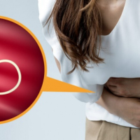 Parazit qurdları, Tibbi Parazitologiya, Qurd xəstəlikləri, helminthologiya, Parazitlərin növü