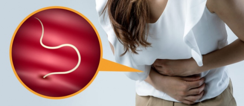 Parazit qurdları, Tibbi Parazitologiya, Qurd xəstəlikləri, helminthologiya, Parazitlərin növü