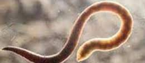 Parazitologiya, ​​​​​​​parazit qurd xəstəlikləri, parazit qurdlar, parazitoloq, bağırsaq qurdları