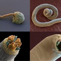 Parazit qurdlara yoluxma, Qurd xəstəlikləri, parazit növləri, Qurd xəstəliklərinin əlamətləri, Qurd xəstəliklərinin fəsadları