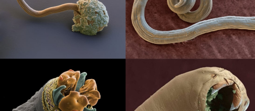 Parazit qurdlara yoluxma, Qurd xəstəlikləri, parazit növləri, Qurd xəstəliklərinin əlamətləri, Qurd xəstəliklərinin fəsadları