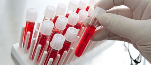 Parazit qurdlara yoluxma, Qurd xəstəlikləri, parazit növləri, Qurd xəstəliklərinin əlamətləri, Qurd xəstəliklərinin fəsadları