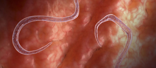 Parazitologiya, Tibbi Parazitologiya, Qurd xəstəlikləri, Askaridlər, Qurd xəstəliklərinin dərmanla müalicəsi