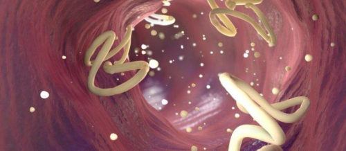 Parazitologiya, Parazit, Parazitologiyanın qolları, Tibbi parazitologiya, parazitlərlə mübarizə