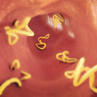 Parazitologiya, Parazit, Parazitologiyanın qolları, Tibbi parazitologiya, parazitlərlə mübarizə