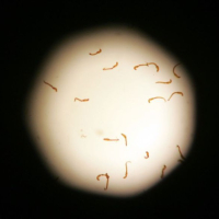 Parazitologiya nədir, medical parazitologiya, parazit növləri, parazitin müalicəsi