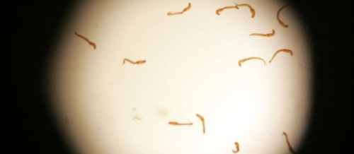 Parazitologiya nədir, medical parazitologiya, parazit növləri, parazitin müalicəsi