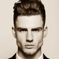 Saç transplantasiyası əməliyyatı, Saç transplantasiyası əməliyyatından əvvəl, Saç əkimi əməliyyatı Saç transplantasiyası əməliyyatı, Saç transplantasiyası əməliyyatından əvvəl, Saç əkimi əməliyyatı