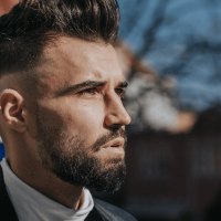 Saç transplantasiyası, Saç transplantasiyası nədir, Saçların bərpası əməliyyatı, Saç əkilməsi əməliyyatı Saç transplantasiyası, Saç transplantasiyası nədir, Saçların bərpası əməliyyatı, Saç əkilməsi əməliyyatı