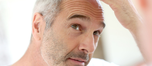 Saç Əkimi, saç əkimi mütəxəssisi, saç əkmə üsulları, Tikişsiz üsul FUE, Saç transplantasiyası