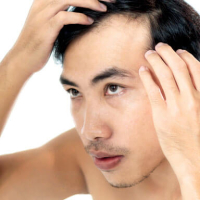 Saç Transplantasiya Mərkəzi, Saç Transplantasiyası nədir, Azərbaycanda saç əkimi, Saç transplantasiyası üsulları Saç Transplantasiya Mərkəzi, Saç Transplantasiyası nədir, Azərbaycanda saç əkimi, Saç transplantasiyası üsulları