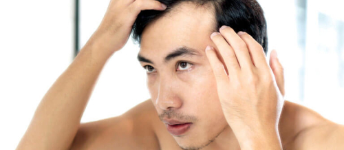 Saç Transplantasiya Mərkəzi, Saç Transplantasiyası nədir, Azərbaycanda saç əkimi, Saç transplantasiyası üsulları