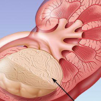 Urologiya şöbəsi, qadın urologiyası, Urologiya nədir, Uroloji xəstəliklər, Kompüter Tomoqrafiya