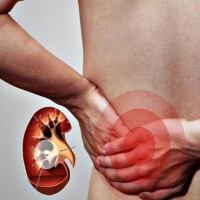 Urologiya şöbəsi, qadın urologiyası, Urologiya nədir, Uroloji xəstəliklər, Kompüter Tomoqrafiya