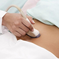 USM nədir, Ultrasəslə müalicəsi, USM müayinəsi, Doppler, USM