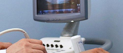 Ultrasəs müayinəsi, Ultrasəs aparatı, Ultrasəs müayinəsi prosedurlaı, Uroloji USM, Ginekoloji USM