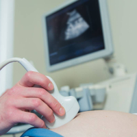 Doppleroqrafiya, Rəngli doppler müayinəsi, USM aparatlar, ultrasonoqrafiya nədir, Ultrasəs cihazı