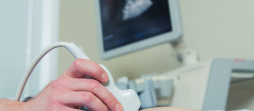 Doppleroqrafiya, Rəngli doppler müayinəsi, USM aparatlar, ultrasonoqrafiya nədir, Ultrasəs cihazı