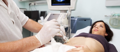 Ultrasonoqrafiya, USM, USM müayinəsinin üstünlükləri, USM-nin növü, Doppleroqrafiya nədir, Ultrasəs nə göstərir