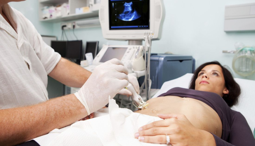 Ultrasonoqrafiya, USM, USM müayinəsinin üstünlükləri, USM-nin növü, Doppleroqrafiya nədir, Ultrasəs nə göstərir