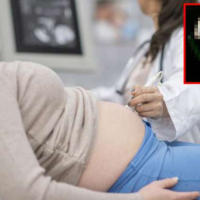 Tibbi ultrasəs nədir, Ultrasəs nə üçün istifadə olunur, Diaqnostik ultrasəs, Ümumi ultrasəs