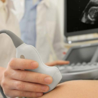 Doppler ultrasəs müayinəsi, Doppler USM-nin faydaları, Doppler USM, Doppler