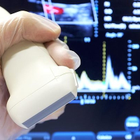 Doppler ultrasəs müayinəsi, Doppler USM-nin faydaları, Doppler USM, Doppler